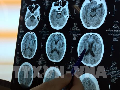 Hà Nội có thêm 2 bệnh nhân ngộ độc rượu chứa Methanol