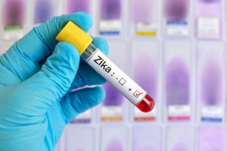 Pháp xác nhận trường hợp đầu tiên nhiễm virus Zika qua đường tình dục