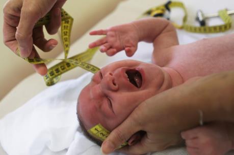 Thêm bằng chứng mới về liên hệ giữa virus Zika và những tổn thương não bộ ở trẻ em