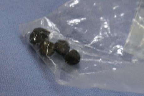 Bé trai 3 tuổi dùng súng đạn chì tự chế bắn bị thương bé 9 tháng tuổi