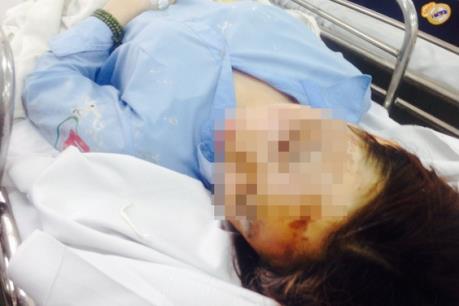 Ba nghi can tạt axit hai nữ sinh trên đường Sài Gòn bị bắt