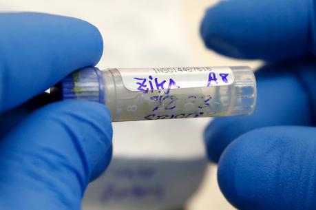 Mỹ xét nghiệm virus Zika bằng phương pháp mới