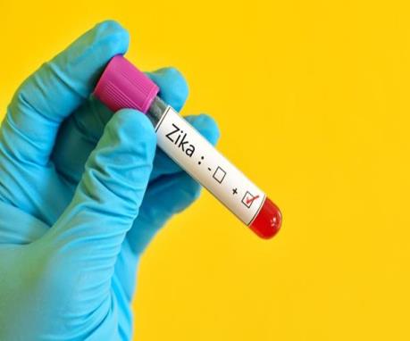 Brazil công bố phương pháp thử mới phát hiện virus Zika trong 20 phút