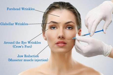 Cảnh báo hậu quả của tự tiêm Botulinum Toxin A