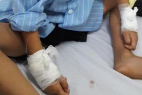 Nghệ An: Đình chỉ chuyên môn bác sỹ mổ nhầm tay trẻ 6 tuổi