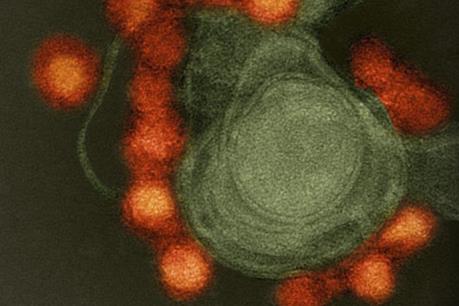 Singapore: Phát hiện ca nhiễm virus Zika đầu tiên do lây truyền trong nước