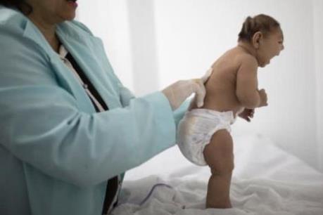 Có mối liên quan giữa vi rút Zika và chứng đầu nhỏ của cháu bé tại Đắk Lắk?