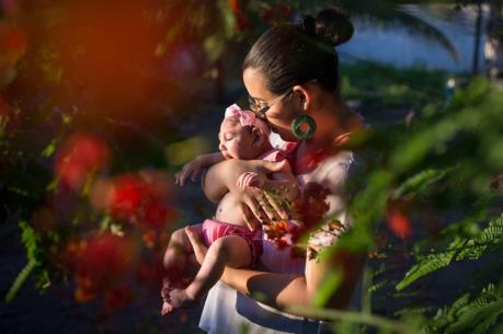 Cần theo dõi lâu hơn trẻ sơ sinh có mẹ nhiễm virus Zika