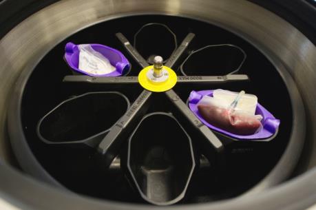 Mỹ phát triển thành công máy ly tâm tách máu thủ công, chi phí thấp