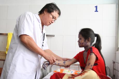 18 quận, huyện ở Hà Nội ghi nhận ca mắc thủy đậu