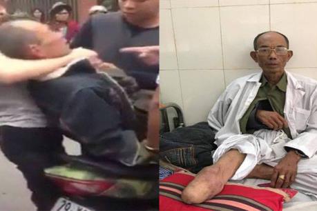 Khởi tố 2 cha con hành hung thương binh sau va chạm giao thông tại Chương Mỹ, Hà Nội