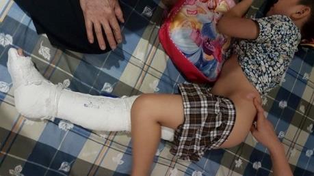 Chủ tịch Hà Nội Nguyễn Đức Chung chỉ đạo làm rõ vụ “xe húc gãy chân học sinh”