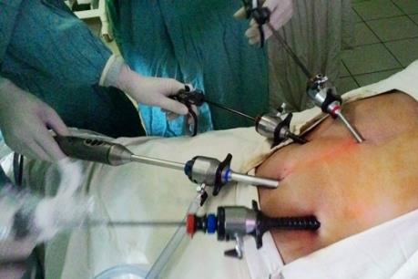 Cần Thơ lần đầu phẫu thuật nội soi cắt u gan thành công cho bệnh nhân ung thư gan