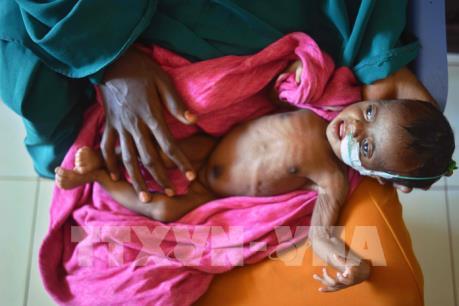 Nạn đói đe dọa gần 110 triệu người trên thế giới