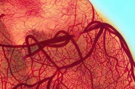 Sở Y tế tỉnh Sóc Trăng thông tin nguyên nhân tử vong của thai phụ sau sinh mổ