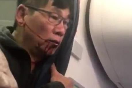 [Clip] Chuyện gì đã xảy ra trước khi bác sĩ gốc Việt bị lôi khỏi máy bay United Airlines?