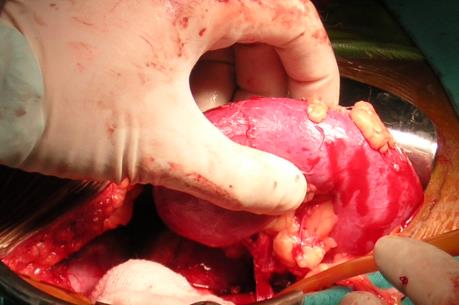 Bí quyết thành công của ngành cấy ghép nội tạng ở Tây Ban Nha