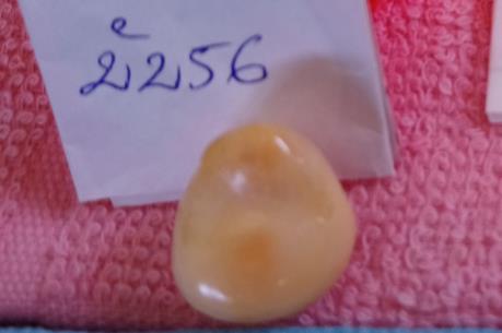 Ngư dân Bạc Liêu đánh bắt được viên ngọc ốc quý hiếm