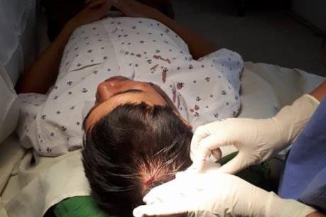 Bộ Y tế yêu cầu khẩn trương xác minh thông tin bác sỹ bị người lạ tấn công rách đầu