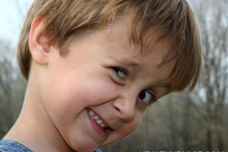 Hội chứng Tic: Định nghĩa, triệu chứng và cách điều trị