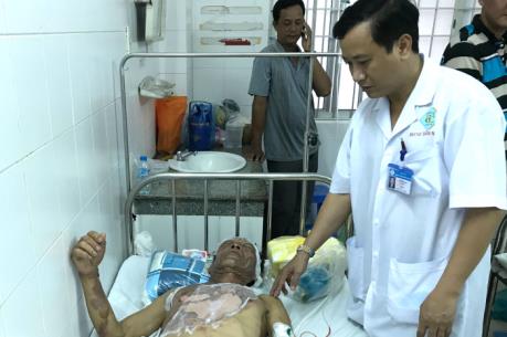 Cảnh báo: Đi ăn cỗ cưới, 8 người bị bỏng nặng do cồn nước