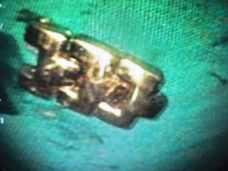 Bệnh nhi 3 tuổi suýt tử vong vì nuốt phải dây đồng hồ bằng kim loại