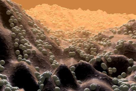 Phát hiện chủng vi khuẩn sống trên da có thể ngăn chặn ung thư