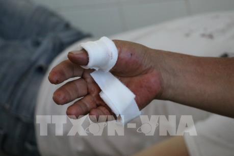 Lâm Đồng khẩn trương điều tra vụ hai cha con bị đạn chì bắn trúng tay