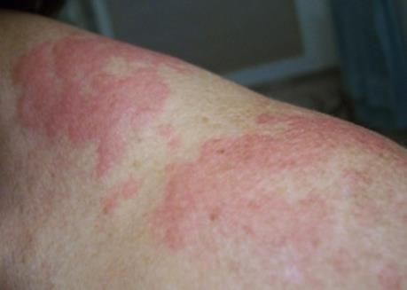 T.p Hồ Chí Minh: Làm rõ vụ một bệnh nhân tử vong bất thường sau điều trị dị ứng