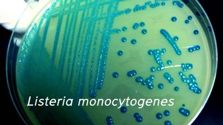 Australia và New Zealand thu hồi nhiều loại rau quả đông lạnh nghi nhiễm khuẩn Listeria