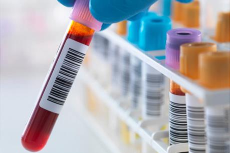 Xét nghiệm viêm gan B - C miễn phí cho 2.000 người dân  ​