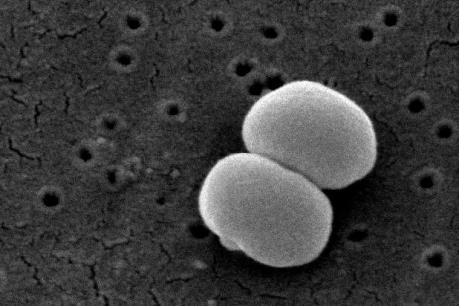 Siêu vi trùng kháng kháng sinh đang lan rộng khắp thế giới