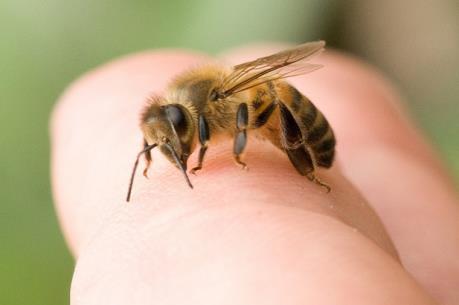 Hôn mê nhiều giờ sau khi bị ong đốt