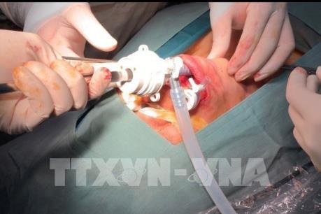 Phẫu thuật nội soi tuyến giáp qua đường miệng không để lại sẹo