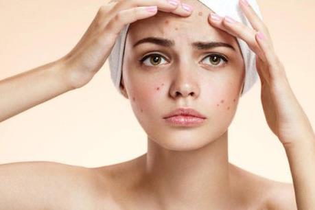 Thu hồi mỹ phẩm sáng da ngừa mụn không đảm bảo chất lượng