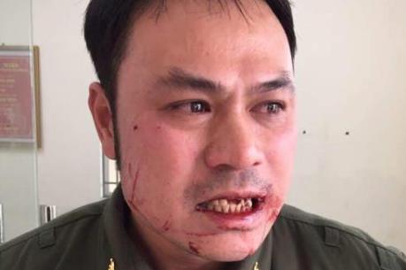 Phó Thủ tướng yêu cầu xử lý nghiêm vụ hành hung nhân viên sân bay