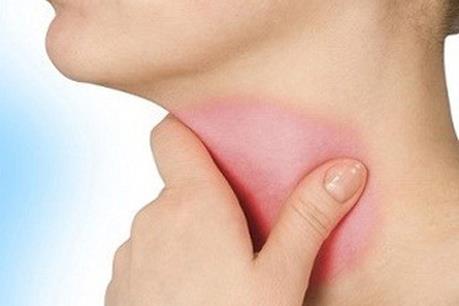 Những thói quen có thể gây ung thư thực quản