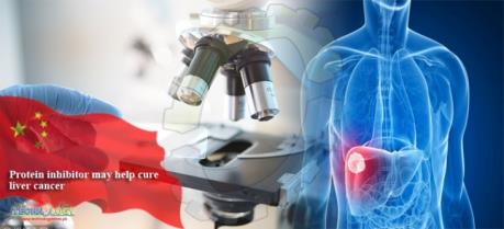 Phát hiện chất ức chế protein SOAT1 hỗ trợ điều trị ung thư gan
