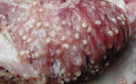 Đã có 124 trẻ Bắc Ninh nhiễm sán lợn