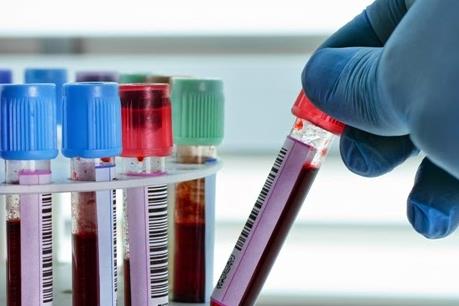 Xuất hiện ca nhiễm cúm gia cầm đầu tiên ở người tại Nội Mông, Trung Quốc