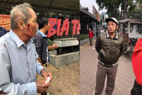 Hà Nội điều tra vụ cụ ông 80 tuổi bị hành hung phải nhập viện