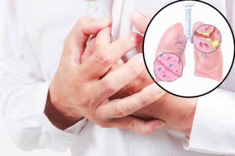 Thái Lan phát hiện bệnh nhân đầu tiên nhiễm virus corona mới
