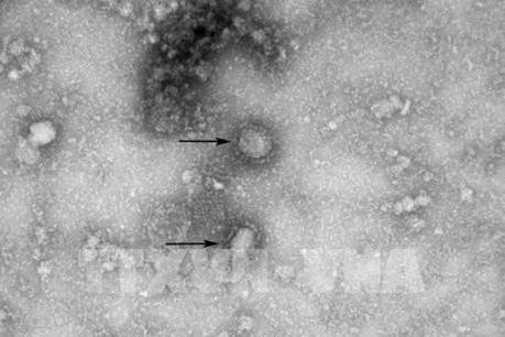 Dịch do virus Corona: Viện Pasteur Paris nuôi cấy thành công các chủng virus Corona mới