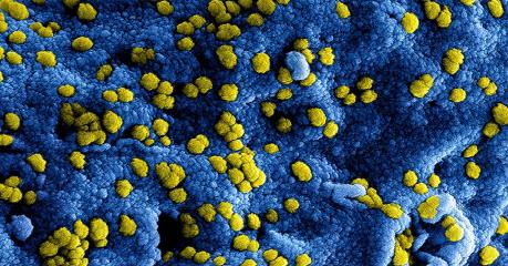 Mỹ điều tra trường hợp thứ hai nghi lây nhiễm virus corona