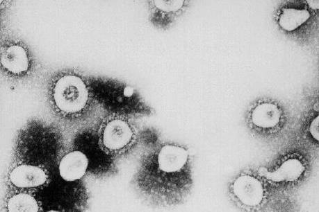 Ba kịch bản kết thúc dịch viêm đường hô hấp cấp do virus Corona
