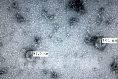 Dịch do virus Corona: Việt Nam nuôi cấy và phân lập thành công virus nCoV