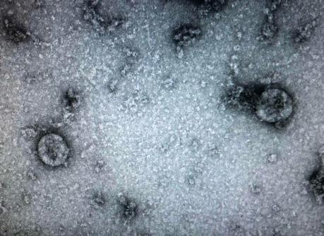 Việt Nam chế tạo thành công kit thử nhanh virus Corona