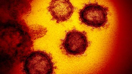 Vẽ bản đồ đường đi của virus Corona mới bằng các mô hình điện toán
