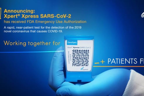 Mỹ: FDA thông qua biện pháp chẩn đoán nhanh virus SARS-CoV-2 trong 45 phút