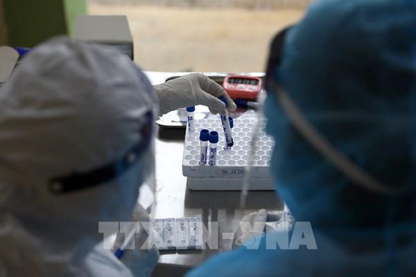 Bình Ðịnh đủ điều kiện xét nghiệm sàng lọc virus SARS-CoV-2